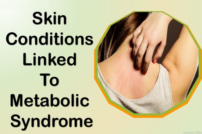 Skin Conditions Linked to Metabolic Syndrome